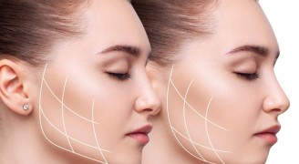 Oval Lining İle Ameliyatsız Dolgunluk