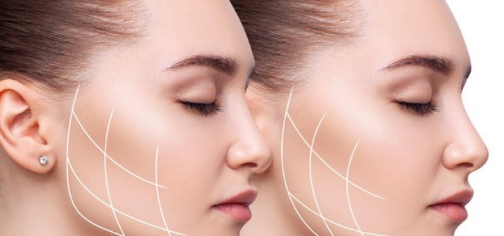 Oval Lining İle Ameliyatsız Dolgunluk