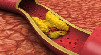 Kolesterol Nedir? Dikkat Edilmesi Gerekenler?
