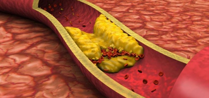 Kolesterol Nedir? Dikkat Edilmesi Gerekenler?
